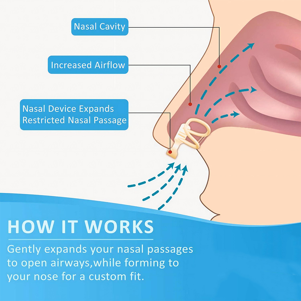 Anti ronco dilatador nasal par - Anti Snore Contour Pillow avaliação e preço